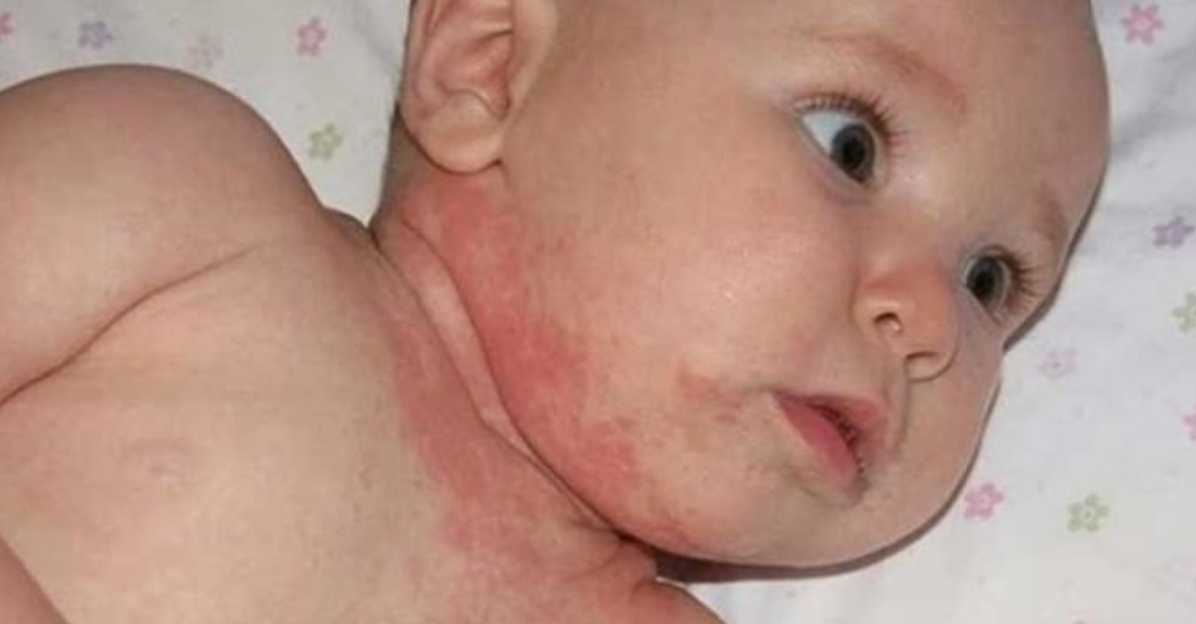inflammation bébé
